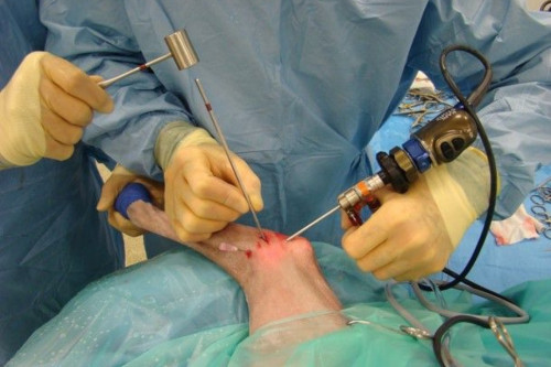 Arthroscopy-Surgery-In-Jaipur.jpg