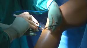 ACL-Ligament-Surgery-in-Bihar.jpg