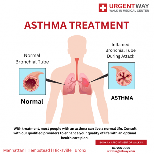 asthma-treatment.png