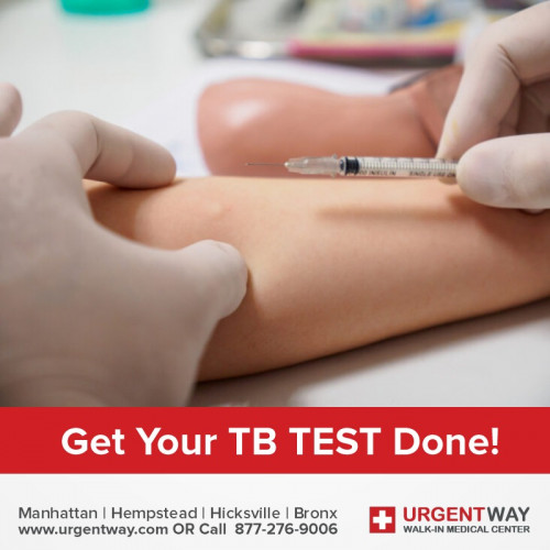 tb-test.jpg