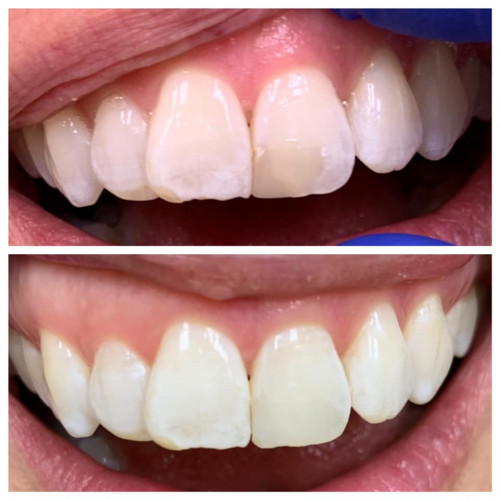 dentists-carmel.jpg