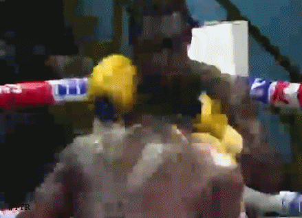 teeeth534cedw43.gif