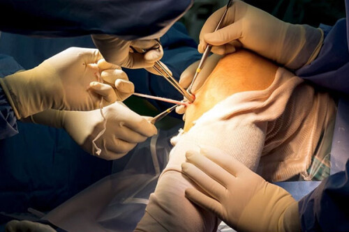 Reliable-Arthroscopy-Surgery-in-Jaipur---Book-Your-Consultation-Today.jpg