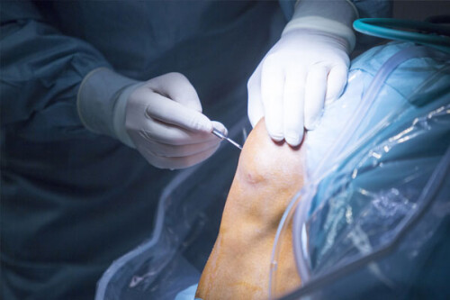Arthroscopy-Surgery-in-Rajasthan-for-Sports-Injuries.jpg